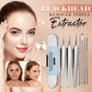 💓Hot sale💥Medical grade blackhead cell clip tool set